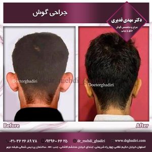 جراحی گوش - دکتر قدیری