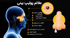 اینفوگرافیک علائم و نشانه‌های رایج پولیپ بینی.