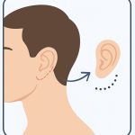 اتوپلاستی چیست؟