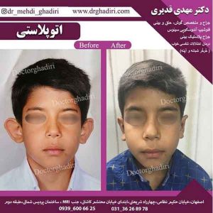 جراحی گوش