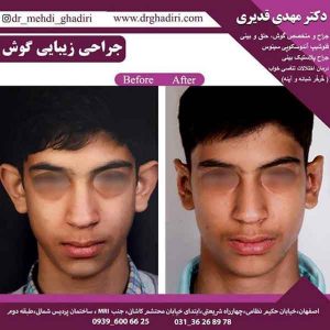جراحی گوش
