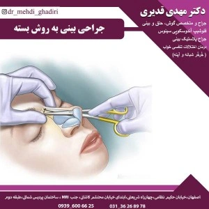 جراحی بینی به روش باز