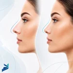 بینی طبیعی یا فانتزی؛ کدام مدل برای شما بهتر است؟