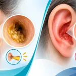 جرم گوش یا عفونت گوش؛ علائم چه تفاوتی دارند؟